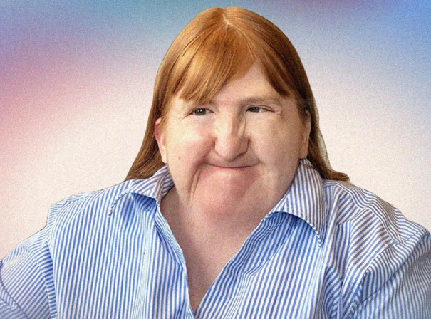 Melissa Blake